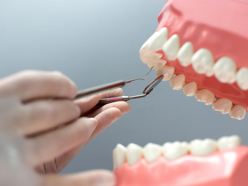 how dental crowns restore damaged teeth to perfection