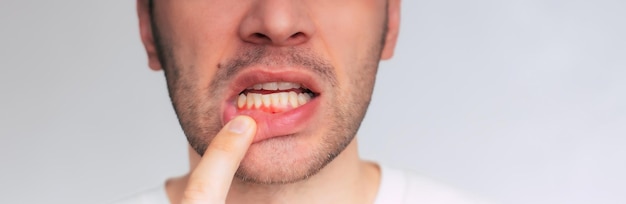 why do my gums look uneven when i smile?